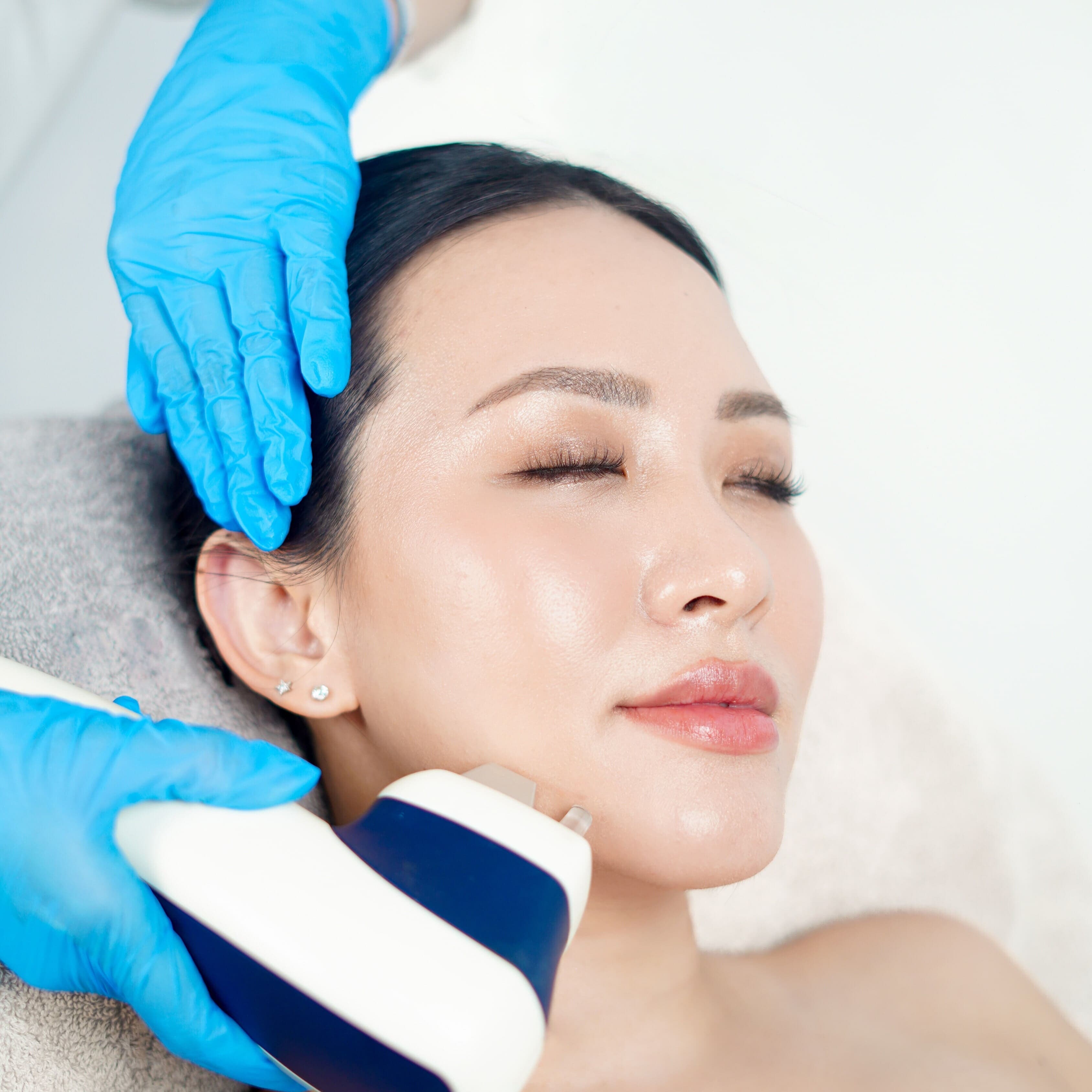 Hindari 7 Hal Ini untuk Mencegah Jerawat di Punggung