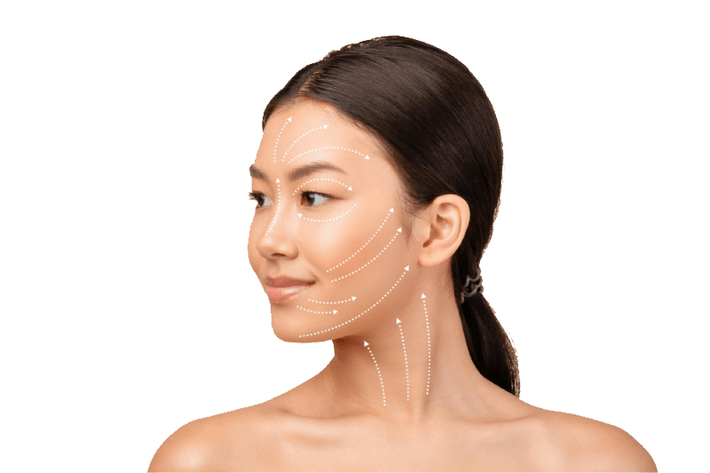 Benang (Thread Lifting)